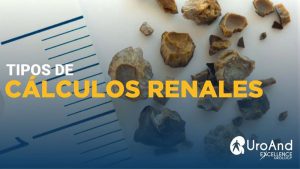tipos de calculos renales