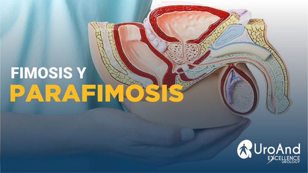 fimosisi y parafimosis excellence urology
