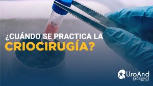 excellence urology criocirugia 2