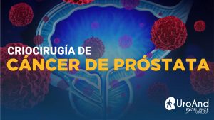 excellence urology criocirugia