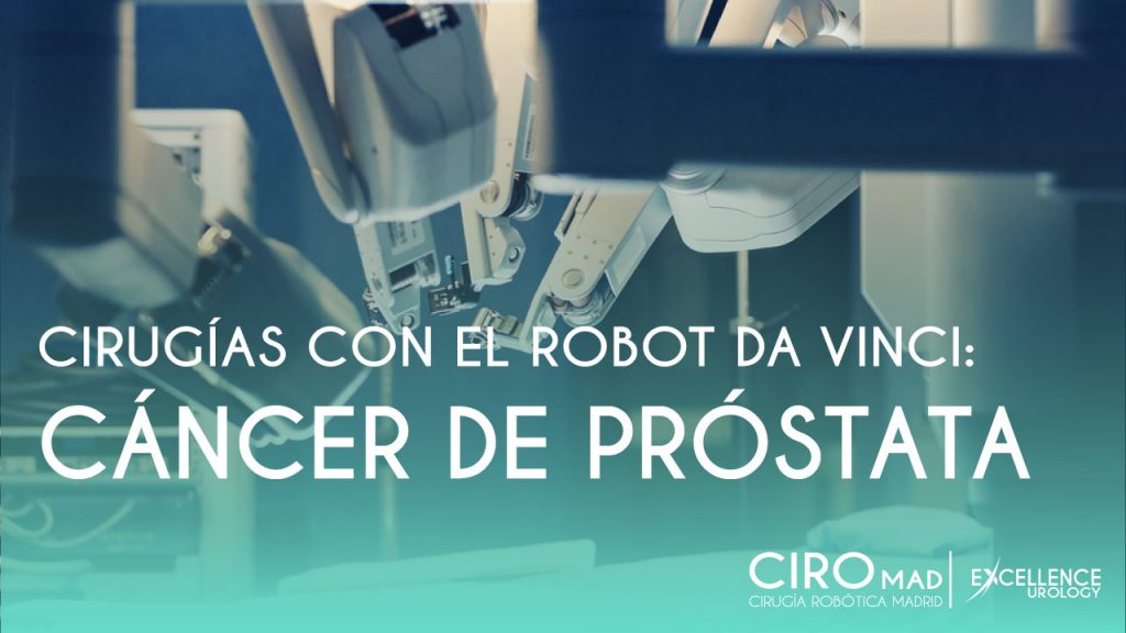 robot da vinci cancer de prostata
