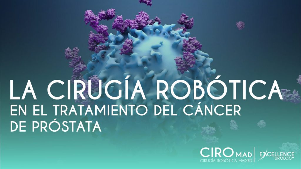 CIRUGIA ROBOTICA CANCER PROSTATA EXCEENCVE UROLOGY