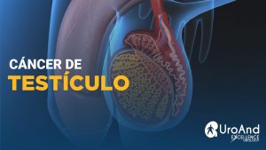 cancer testicuo excellence urology