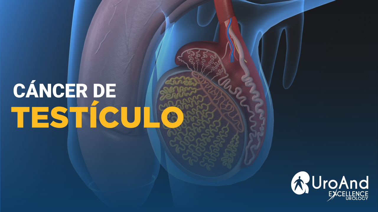 Cáncer de testículo - Excellence Urology