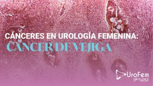 cancer vejiga urofem