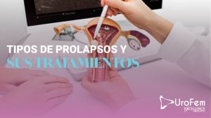 tipos prolapso tratamiento excellence urology