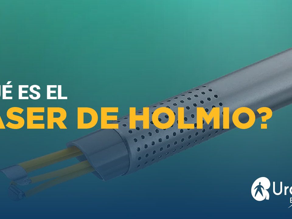 laser de holmio excellence urology