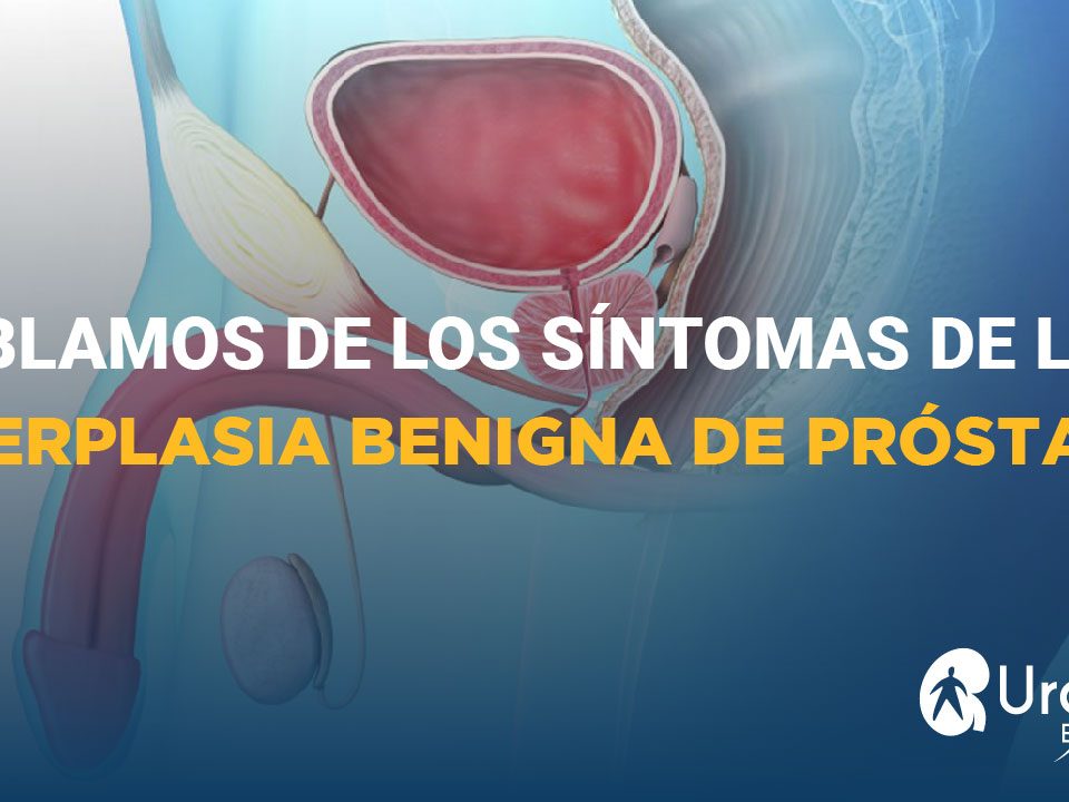 sintomas hiperplasia benigna prostata excellence urology 1