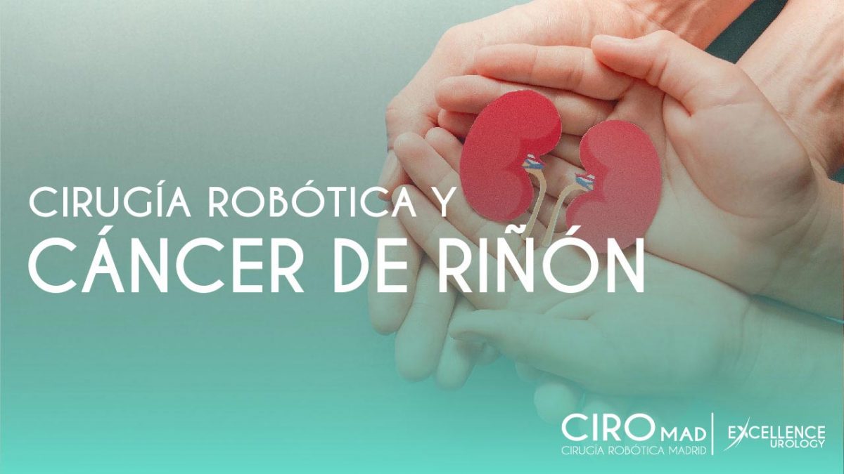 cirugia robotica y cancer de rinon excellence urology