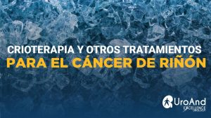 crioterapia cancer de rinon excellence urology