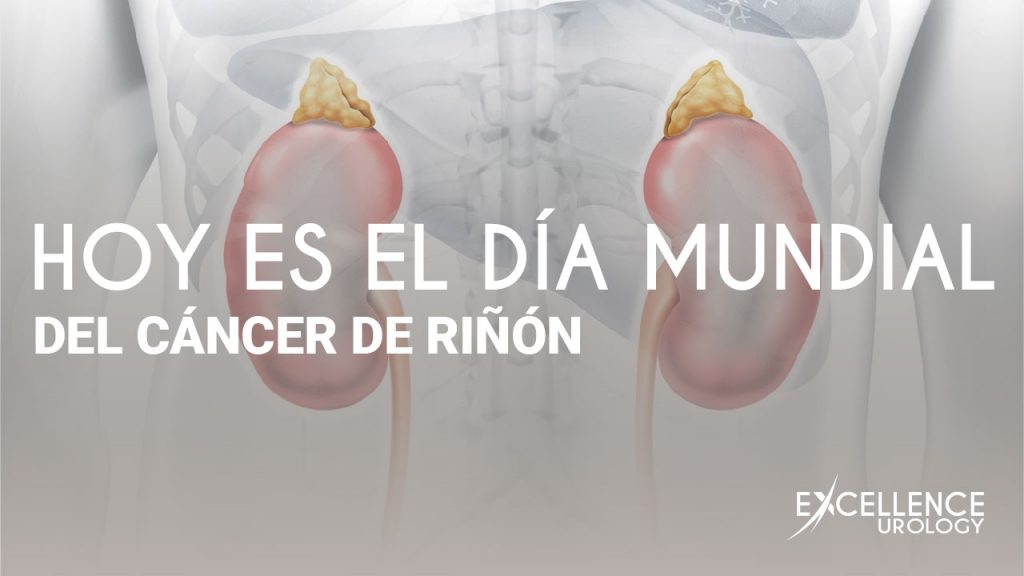 dia mundial cancer de rinon excellence urology 38