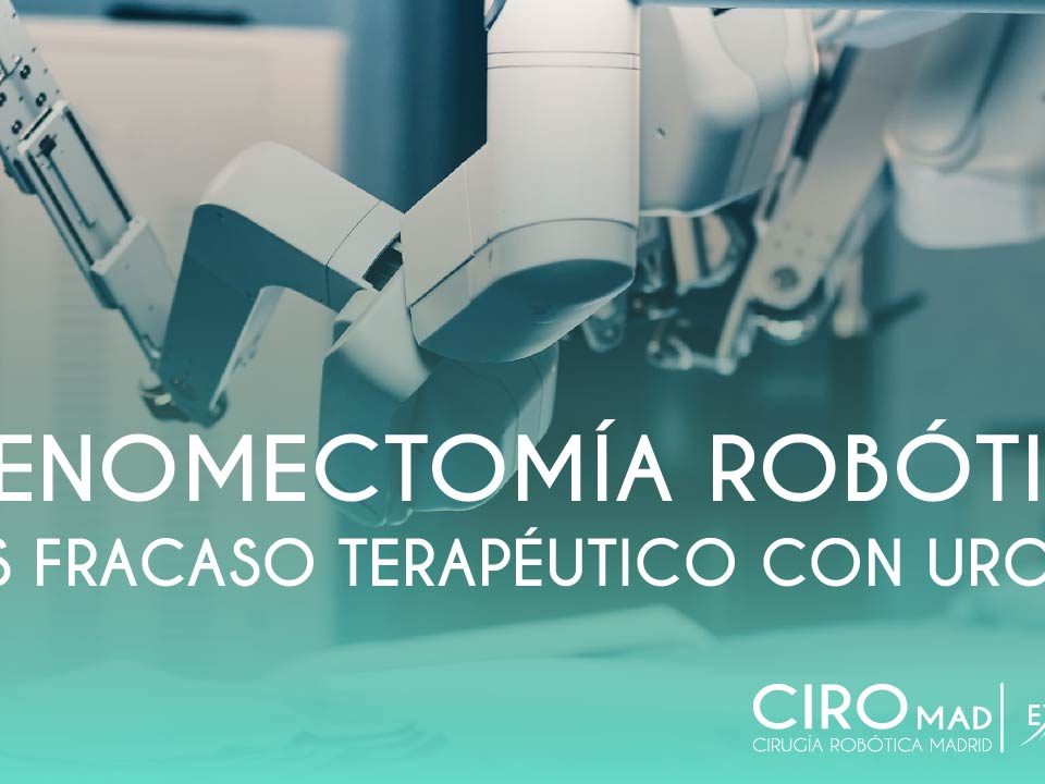 Adenomectomia robotica tras fracaso terapeutico primario con Urolift excellence urology 36