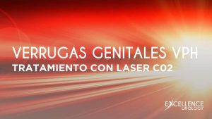 TRATAMIENTO VERRUGAS VPH CON LASER C02 EXCELLENCE UROLOGY