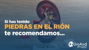 Piedras en el riñón