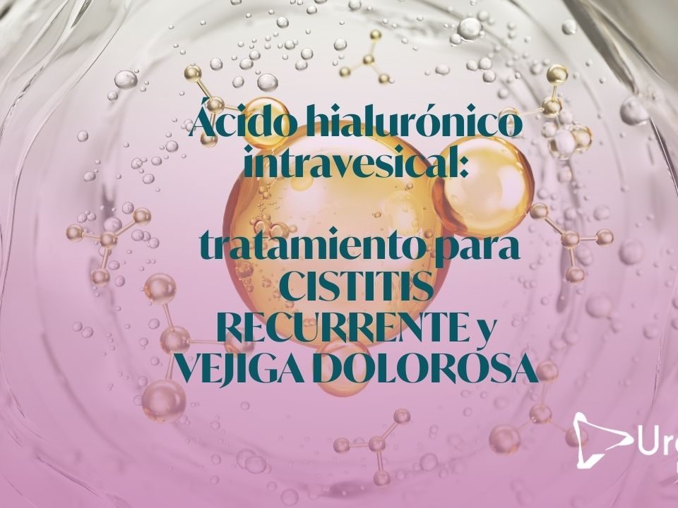 Ácido hialurónico intravesical: tratamiento para cistitis recurrente y vejiga dolorosa