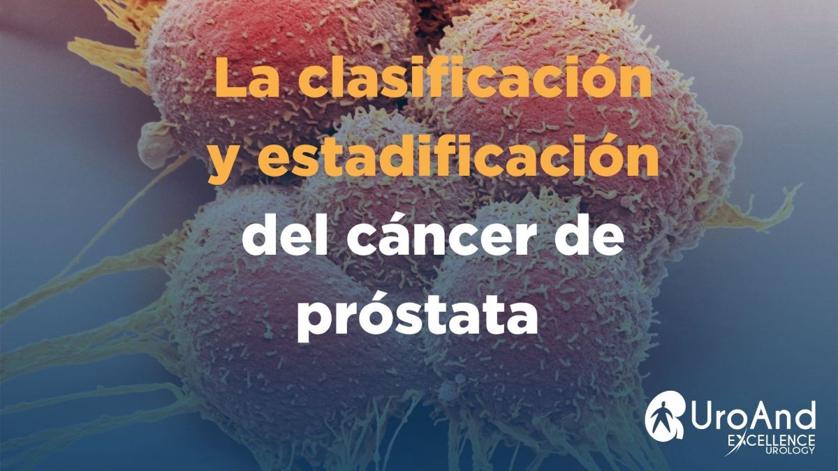 BLOG UROAND. Clasificacion y estadificacion del cáncer de próstata